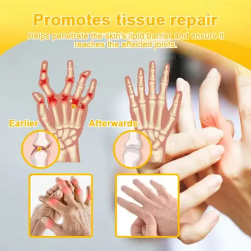XRLXRL™ Bee Venom Pain-Relief Bone Healing Cream