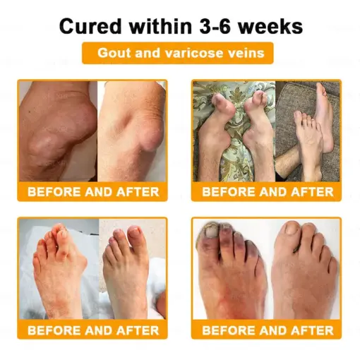 XRLXRL™ Bee Venom Pain-Relief Bone Healing Cream