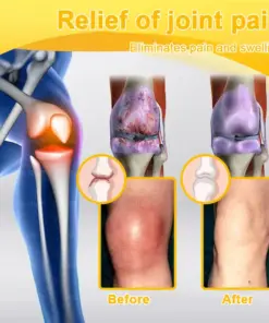 XRLXRL™ Bee Venom Pain-Relief Bone Healing Cream