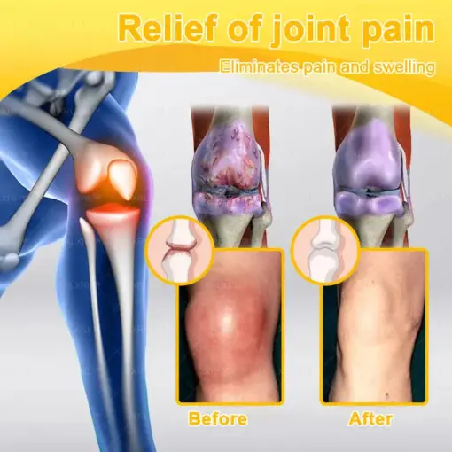 XRLXRL™ Bee Venom Pain-Relief Bone Healing Cream
