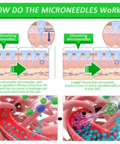 𝗟𝗺𝗶𝗽𝗸𝗶® Nano Microneedle Patch with SMGT-GLP-1 & Matrixyl 3000