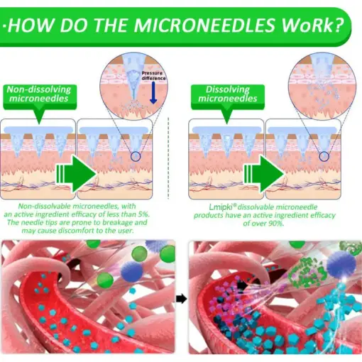 𝗟𝗺𝗶𝗽𝗸𝗶® Nano Microneedle Patch with SMGT-GLP-1 & Matrixyl 3000
