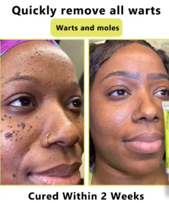 𝙇𝙢𝑖𝑝𝙠𝙞® Derma Repair Cream