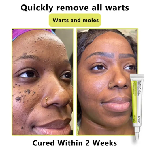 𝙇𝙢𝑖𝑝𝙠𝙞® Derma Repair Cream