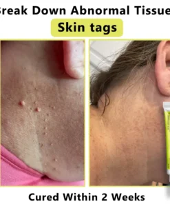 𝙇𝙢𝑖𝑝𝙠𝙞® Derma Repair Cream