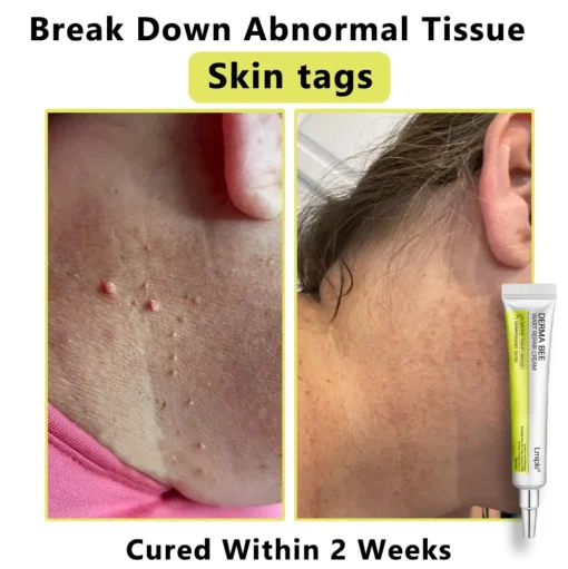 𝙇𝙢𝑖𝑝𝙠𝙞® Derma Repair Cream