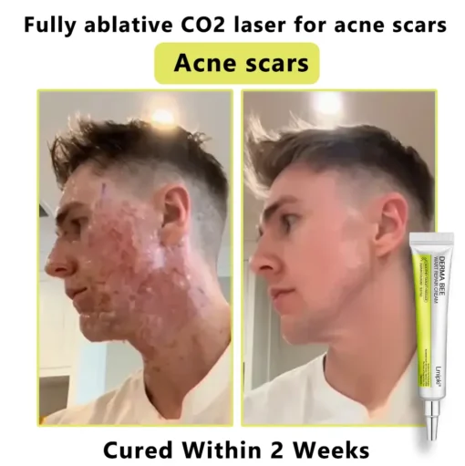 𝙇𝙢𝑖𝑝𝙠𝙞® Derma Repair Cream