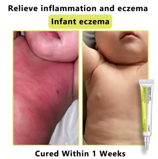 𝙇𝙢𝑖𝑝𝙠𝙞® Derma Repair Cream