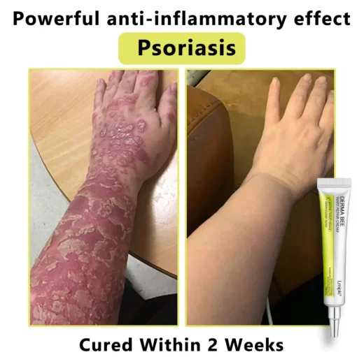 𝙇𝙢𝑖𝑝𝙠𝙞® Derma Repair Cream