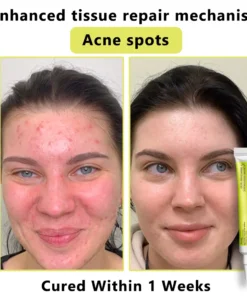𝙇𝙢𝑖𝑝𝙠𝙞® Derma Repair Cream