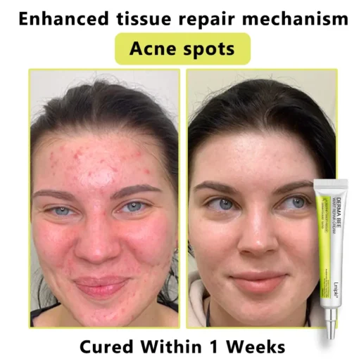 𝙇𝙢𝑖𝑝𝙠𝙞® Derma Repair Cream