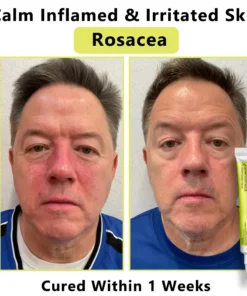 𝙇𝙢𝑖𝑝𝙠𝙞® Derma Repair Cream