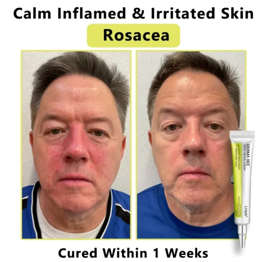 𝙇𝙢𝑖𝑝𝙠𝙞® Derma Repair Cream