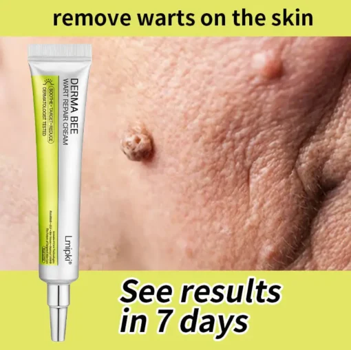 𝙇𝙢𝑖𝑝𝙠𝙞® Derma Repair Cream