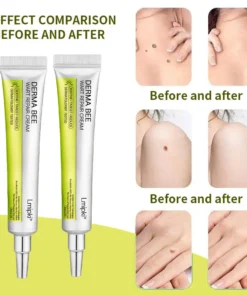 𝙇𝙢𝑖𝑝𝙠𝙞® Derma Repair Cream